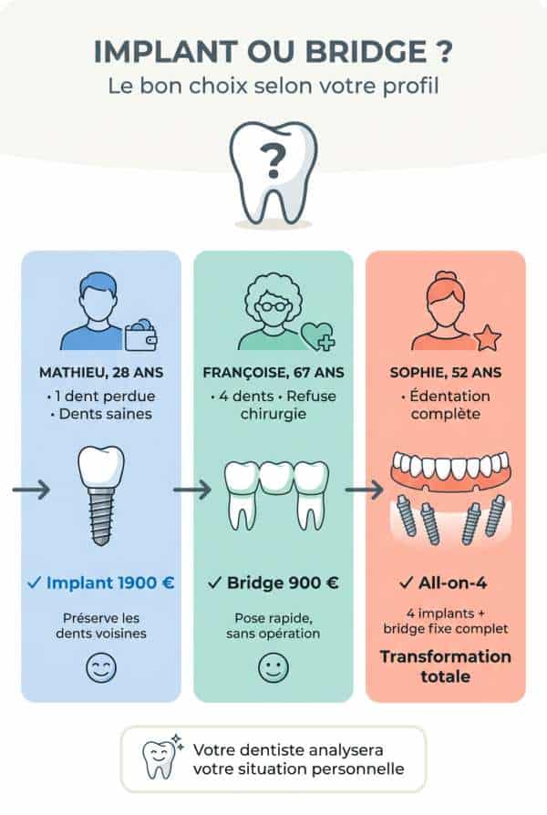 Profil A : jeune adulte, dent unique, budget serré vs profil B : senior, édentation multiple, priorité confort